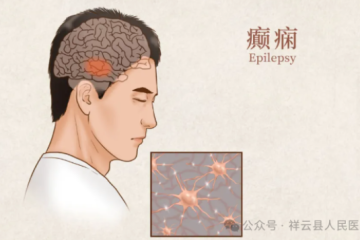 【健康科普】6.28国际癫痫关爱日——看见罕见  普及认知
